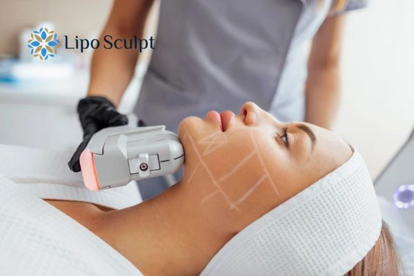 HIFU vs Botulinum Toxin: Understanding the Differences 1 HIFU vs Botox Braintree What is the best option for you?