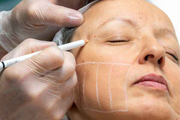CryoPen: 5 Skin Concerns It May Be Used to Treat 4 What should you ask before having CryoPen treatment Braintree?